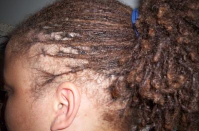 Colored Loc Puff Up Close